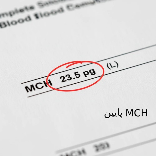 محدوده طبیعی MCH معمولاً بین 27 تا 33 پیکوگرم (pg) است. بنابراین، مقدار 23.5 pg که در این گزارش آمده، پایین تر از حد طبیعی محسوب می شود.