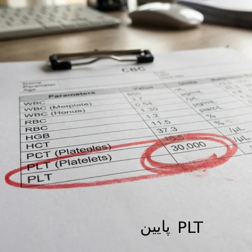 در این آزمایش، عدد PLT (پلاکتها) برابر با 30,000 ثبت شده است. برای درک وخامت اوضاع، باید بدانید که رنج نرمال پلاکت بین ۱۵۰,۰۰۰ تا ۴۵۰,۰۰۰ است. عدد ۳۰,۰۰۰ یعنی پلاکتهای این فرد حدوداً یکپنجمِ حداقلِ مقدار طبیعی است!