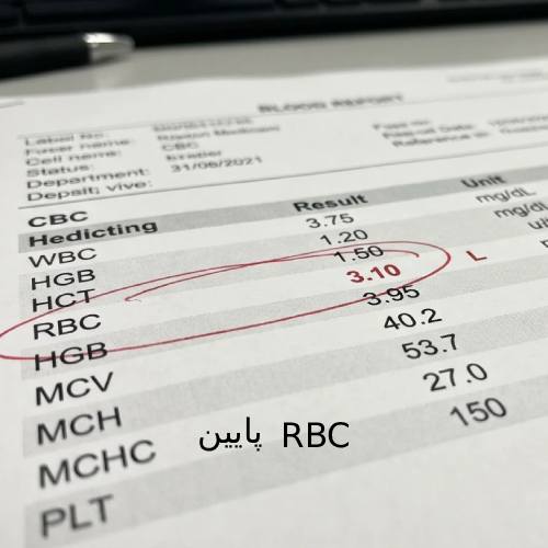 در این برگه آزمایش، تمرکز روی عدد RBC (گلبولهای قرمز) است که مقدار آن 3.10 (میلیون در میکرولیتر) ثبت شده و کنار آن علامت L (Low) به معنای پایین بودن قرار دارد. رنج نرمال معمولاً بالای ۴ یا ۴.۵ است.