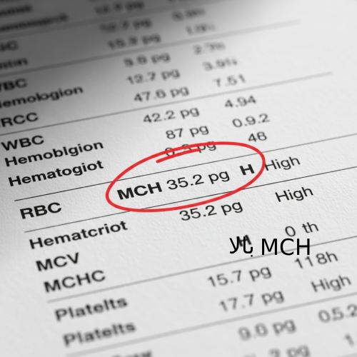 در تصویر مقدار MCH = 35.2 pg مشخص شده که کنار آن حرف H (High) آمده، یعنی بالاتر از حد طبیعی.