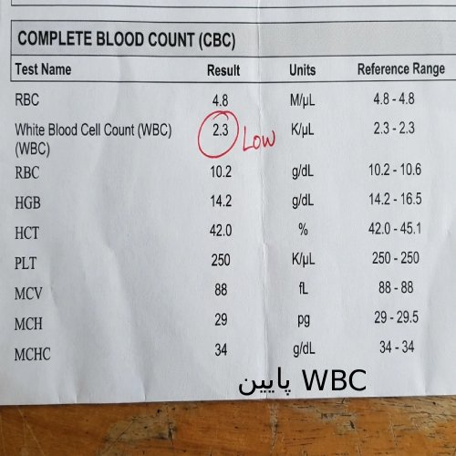 تحلیل دقیق تصویر: در این برگه آزمایش، همانطور که با دایره قرمز مشخص شده است، مقدار WBC (گلبولهای سفید) عدد 2.3 (یا ۲۳۰۰ عدد در میکرولیتر) را نشان میدهد. از آنجایی که محدوده نرمال گلبولهای سفید معمولاً بین ۴.۵ تا ۱۱ است، این عدد نشاندهنده وضعیت لوکوپنی (Leukopenia) یا کاهش سطح گلبولهای سفید است.