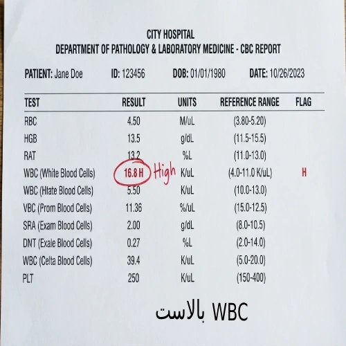 در این برگه آزمایش، مقدار WBC (گلبولهای سفید) عدد 16.8 (یا ۱۶۸۰۰ در میکرولیتر) را نشان میدهد. از آنجا که رنج نرمال در این آزمایشگاه بین ۴.۰ تا ۱۱.۰ تعریف شده، جلوی این عدد حرف H (مخفف High) به معنی بالا درج شده است.
