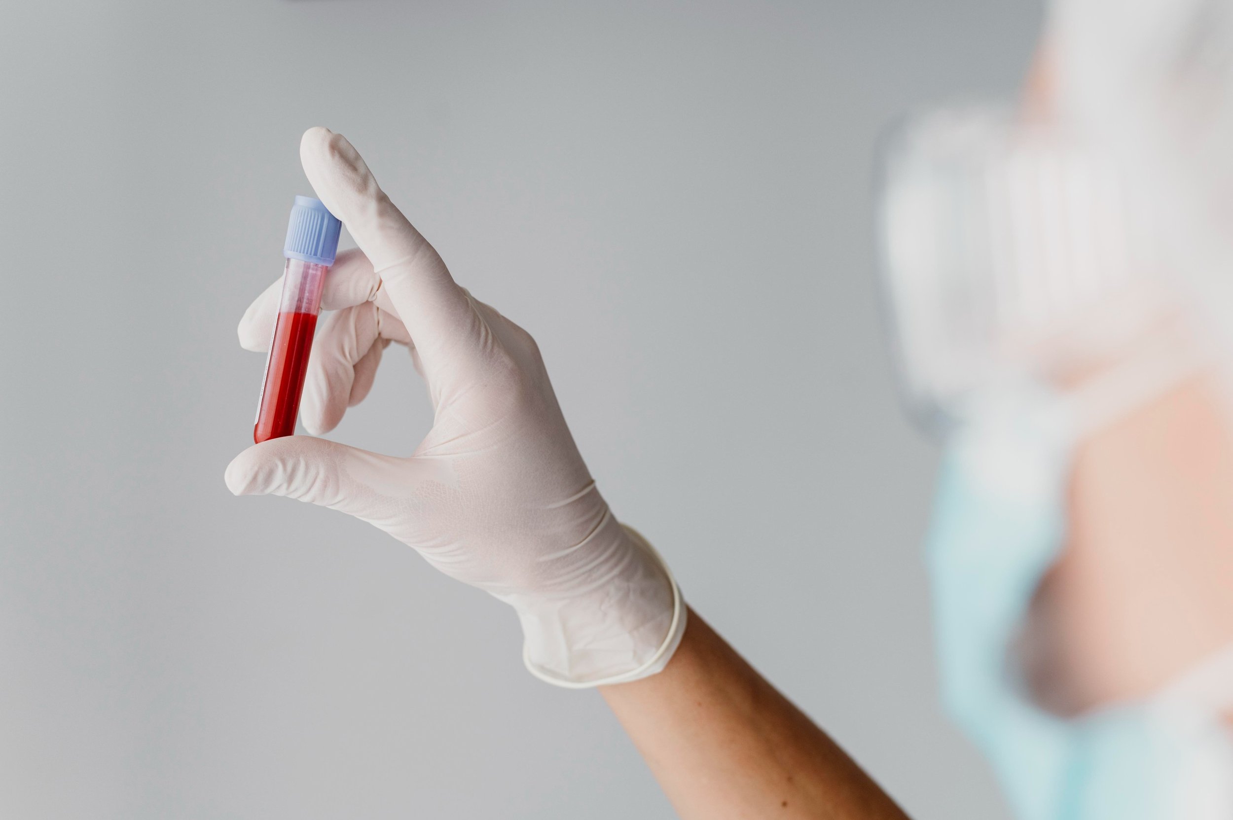 Blood+sample+to+test+for+diabetes