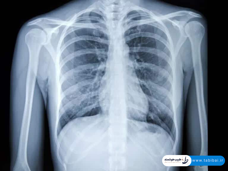 ct-scan-chest-abdomen-pelvis-what-shows-why-prescribed-1