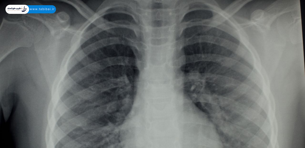 ct-scan-chest-abdomen-pelvis-what-shows-why-prescribed-2