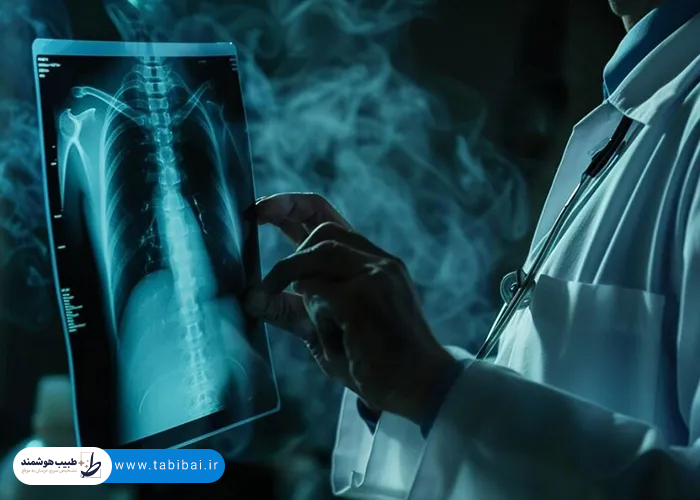 ct-scan-chest-abdomen-pelvis-what-shows-why-prescribed-3