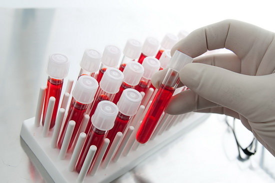 liver-kidney-test-interpretation-full-guide-5