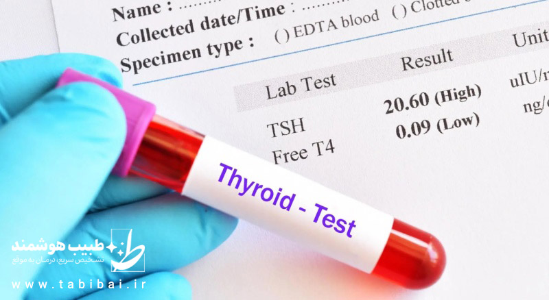 what-is-Thyroid-images3